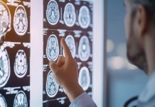 inteligencia-artificial-impulsa-deteccion-temprana-y-avances-en-el-tratamiento-del-parkinson