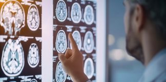 inteligencia-artificial-impulsa-deteccion-temprana-y-avances-en-el-tratamiento-del-parkinson