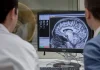 Científicos desarrollan terapia génica para prevenir el alzhéimer cientificos-desarrollan-terapia-genica-para-prevenir-el-alzheimer