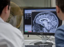 Científicos desarrollan terapia génica para prevenir el alzhéimer cientificos-desarrollan-terapia-genica-para-prevenir-el-alzheimer